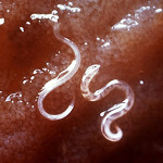 Hookworm Source: wikipedia.org