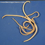 Roundworm Source: roundwormpictures.com