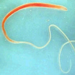 Whipworm Source: myvictoriavet.com